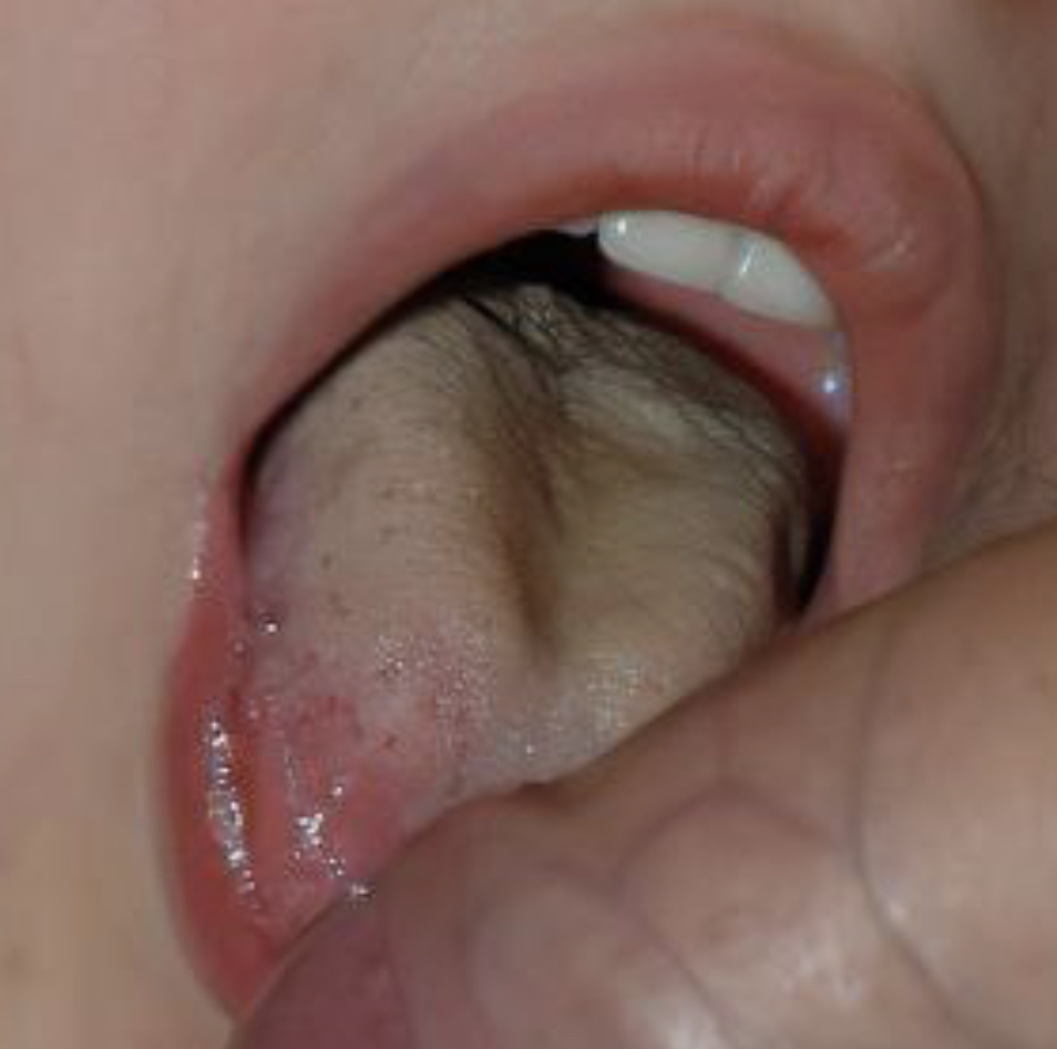 113235-c1978c906561.jpeg