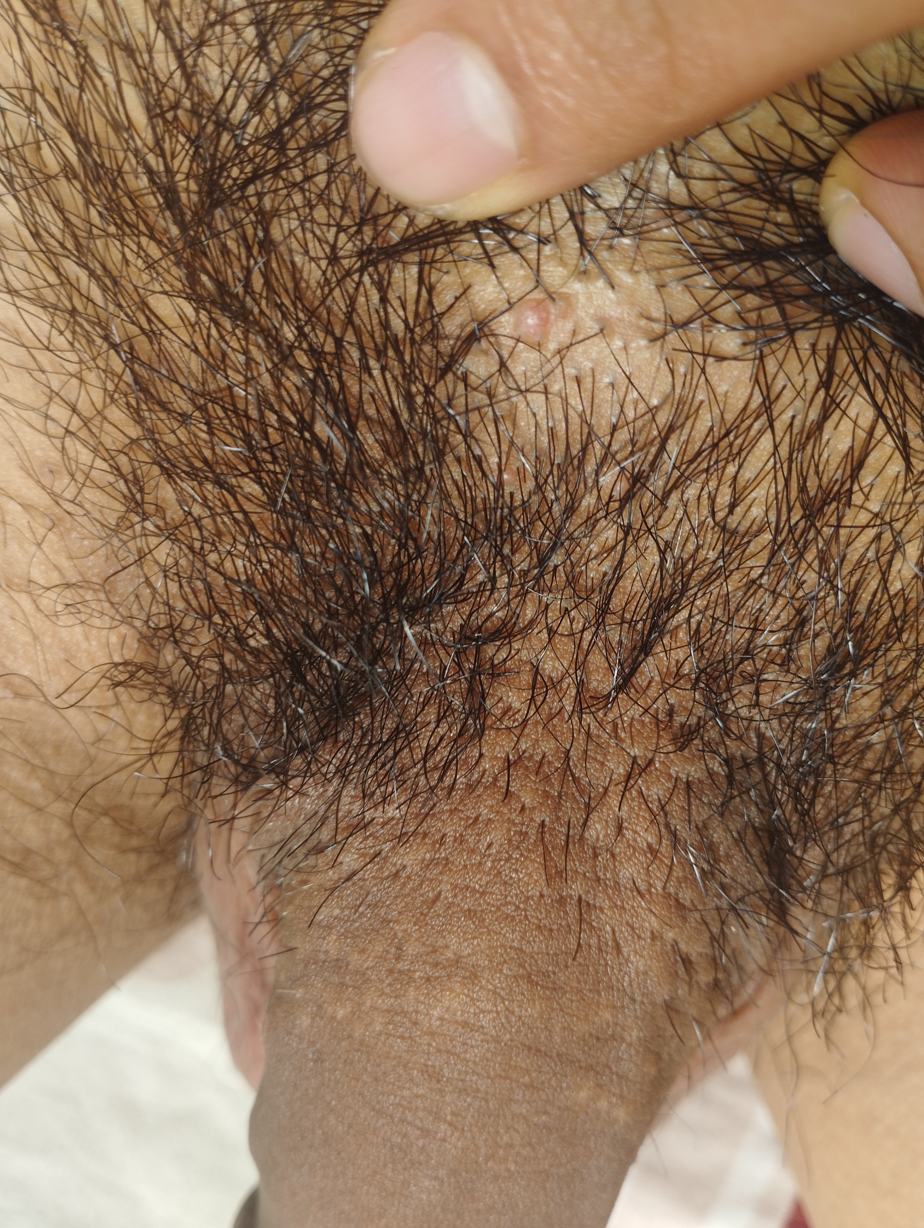 123877-7faf9a197843.jpg