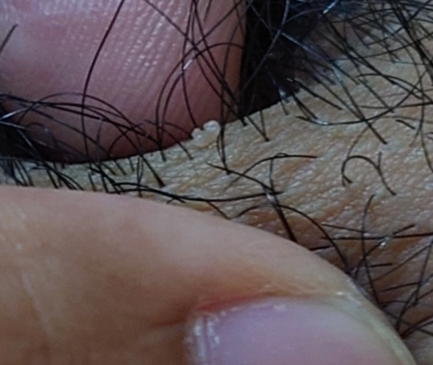 153701-a6b3d270030a.png