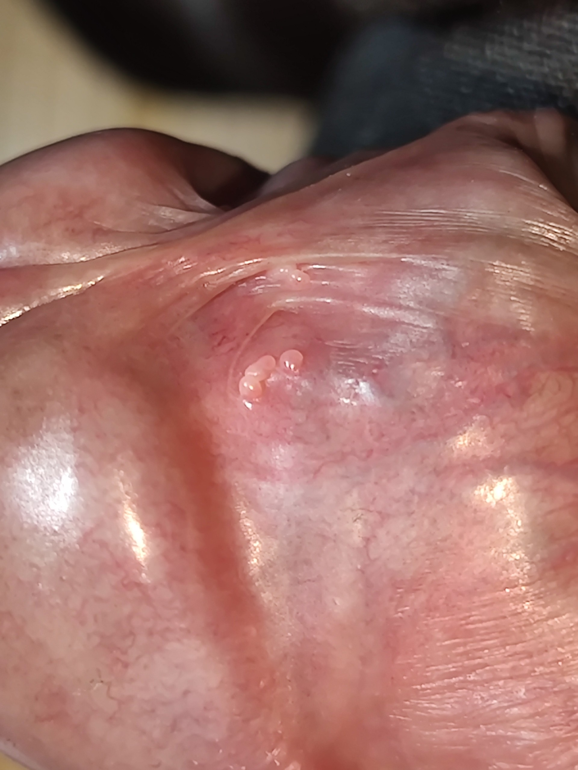 169890-8cf5e3b0215c.png