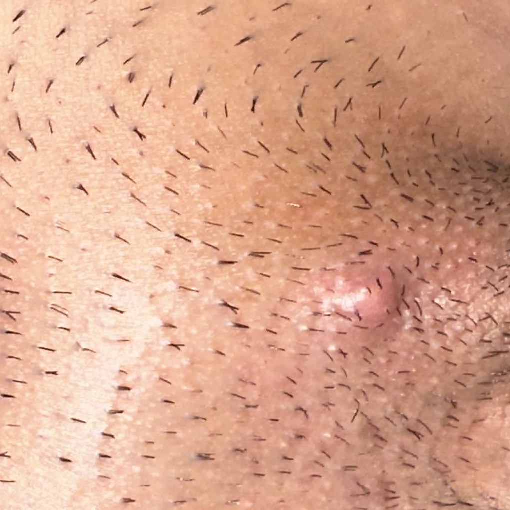 181012-4c3e630aec21.jpeg
