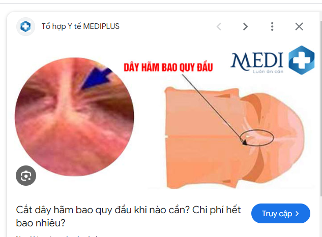 249233-d2f0de201e56.png