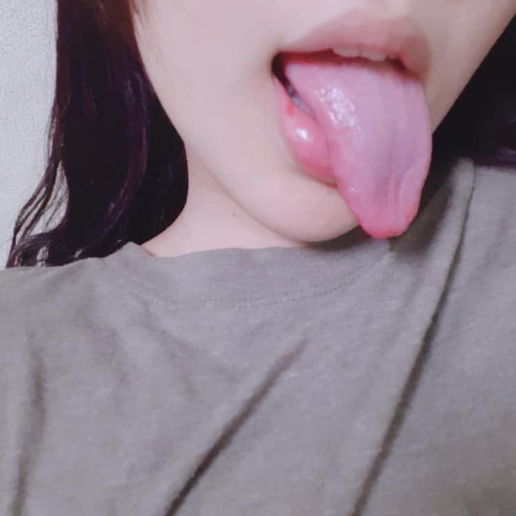 264351-f6a93a81fff4.png
