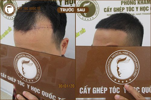51539-0445479d829d.png