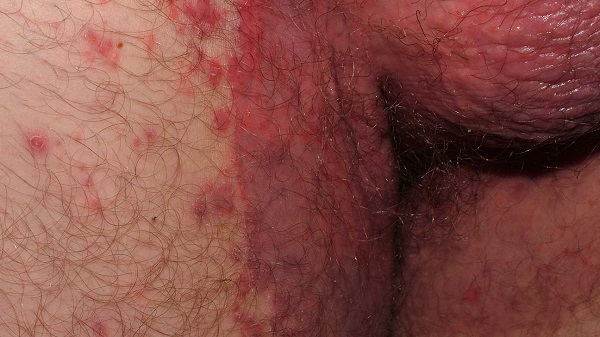 89175-fb7c65dbf761.jpg